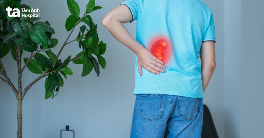 nguyên tắc khi điều trị thận ứ nước độ 2 tại nhà