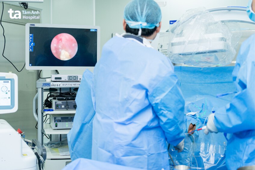 nội soi tán sỏi niệu quản bằng laser