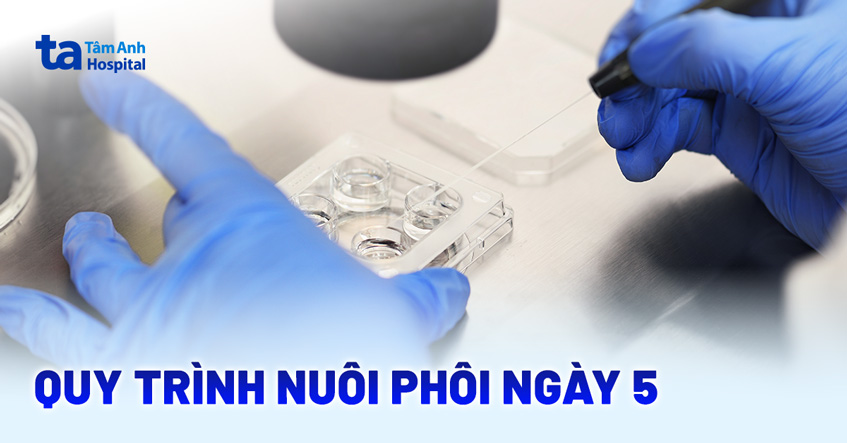 Nuôi phôi ngày 5 là gì? Ưu điểm, chỉ định và quy trình và tỷ lệ
