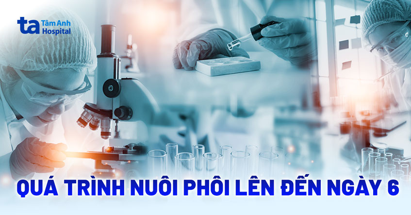 Nuôi phôi ngày 6 là gì? Ưu điểm, quy trình và tỷ lệ thành công