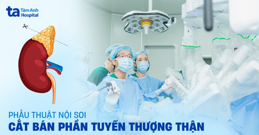 Phẫu thuật nội soi cắt bán phần tuyến thượng thận: Ưu nhược điểm