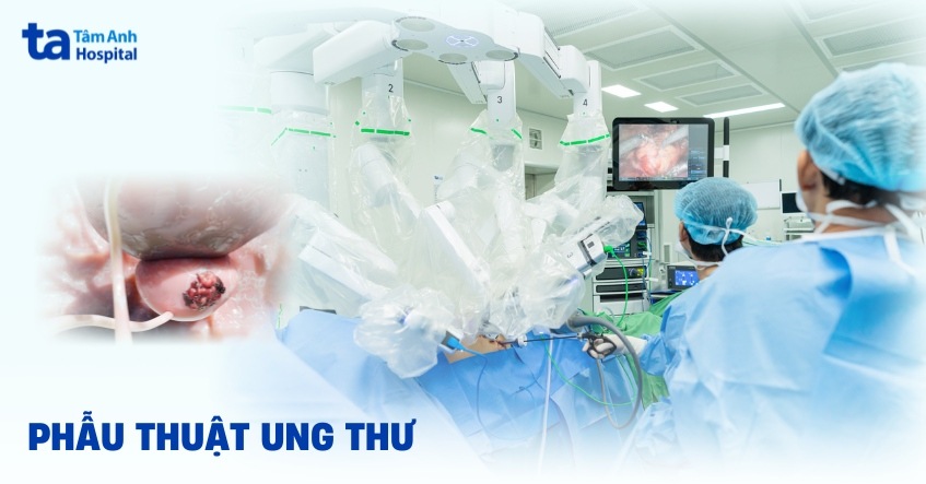 4 phương pháp phẫu thuật ung thư: Nguyên tắc, mục tiêu và chỉ định