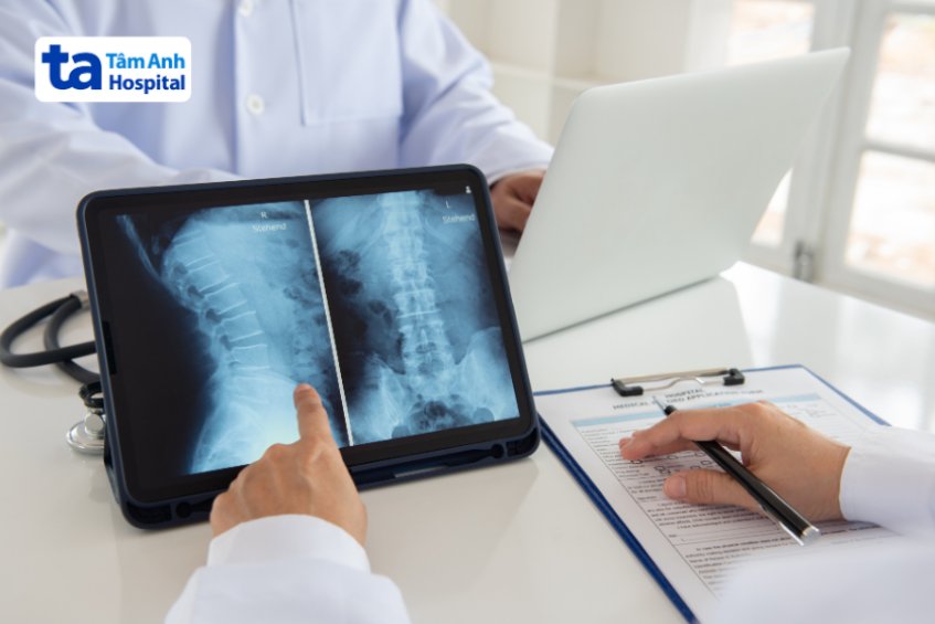 Phương pháp chẩn đoán rách bao xơ đĩa đệm