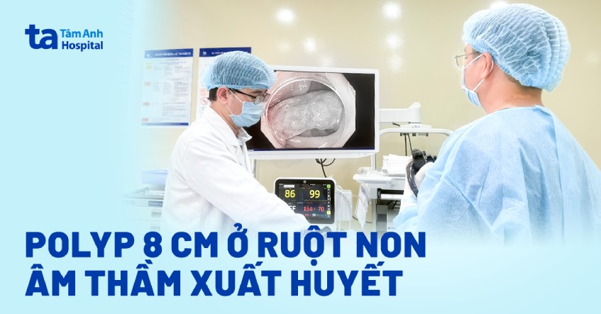 polyp 8 cm ở ruột non âm thầm xuất huyết