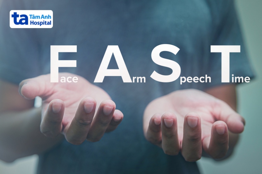 quy tắc fast trong tai biến cần lưu ý