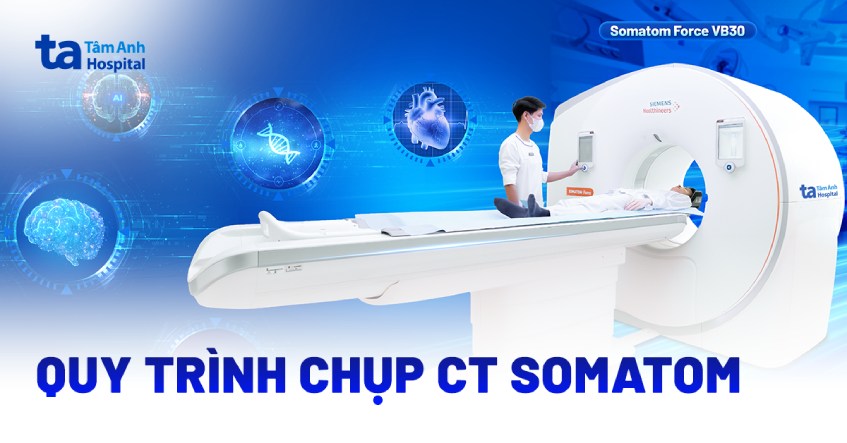 Quy trình chụp CT Somatom Force VB30 mất bao lâu, có đau không?