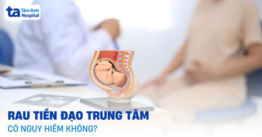 Rau tiền đạo trung tâm có nguy hiểm không? Cách xử lý an toàn
