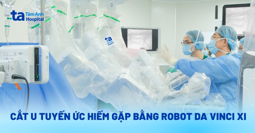 Robot Da Vinci Xi cắt u tuyến ức hiếm gặp ở vị trí hiểm