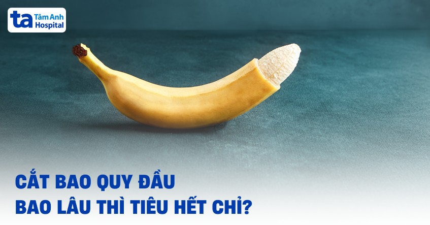 Cắt bao quy đầu bao lâu thì tiêu hết chỉ​? Không tự tiêu có cần tháo?