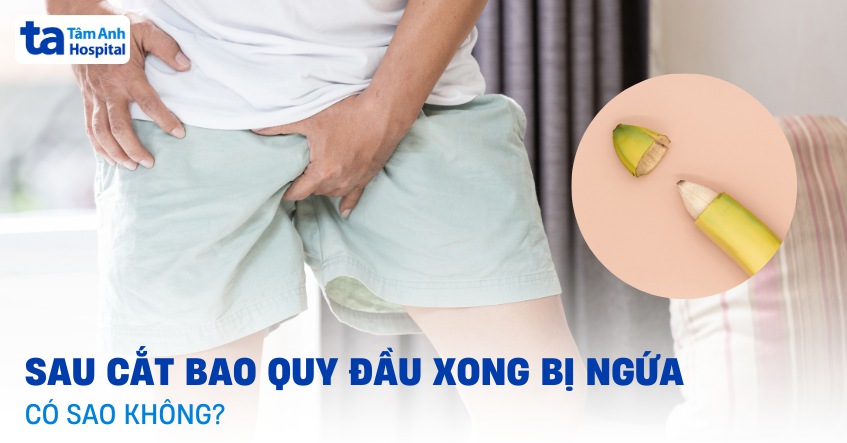 Sau khi cắt bao quy đầu xong bị ngứa có sao không? Xử lý ra sao?