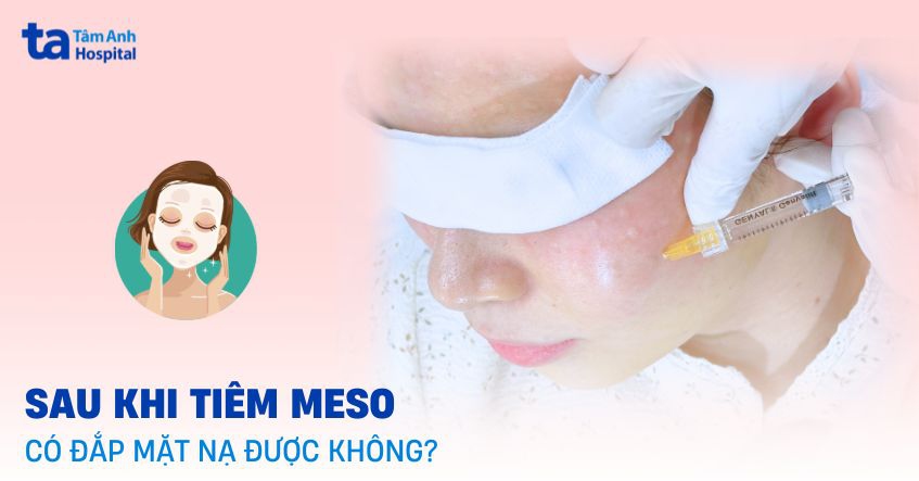 Sau khi tiêm meso có đắp mặt nạ được không? Cần lưu ý điều gì?