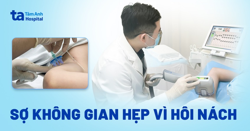 sợ không gian hẹp vì hôi nách