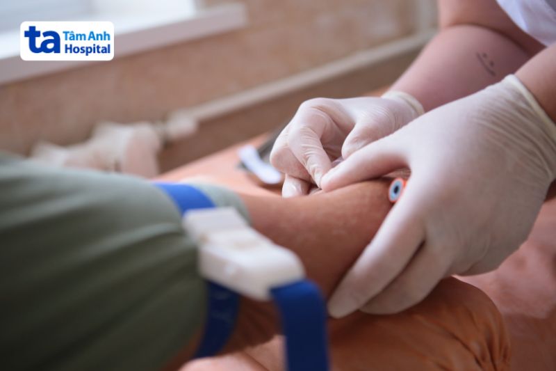 xét nghiệm chẩn đoán bệnh sốt rét