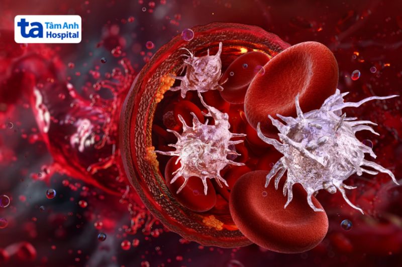 sốt xuất huyết hạ tiểu cầu cần nhập viện