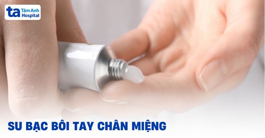 su bạc bôi tay chân miệng