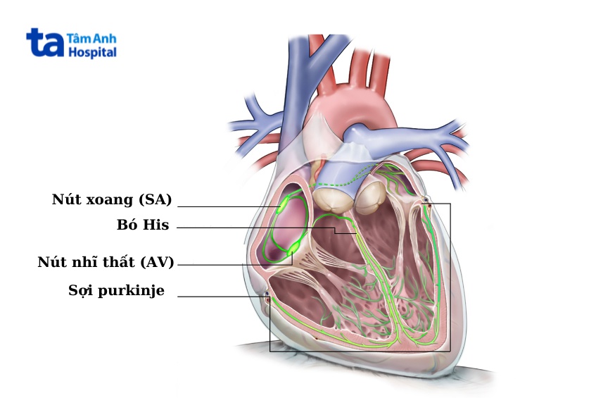 Rối loạn chức năng nút xoang là loại rối loạn nhịp xuất phát từ nút xoang