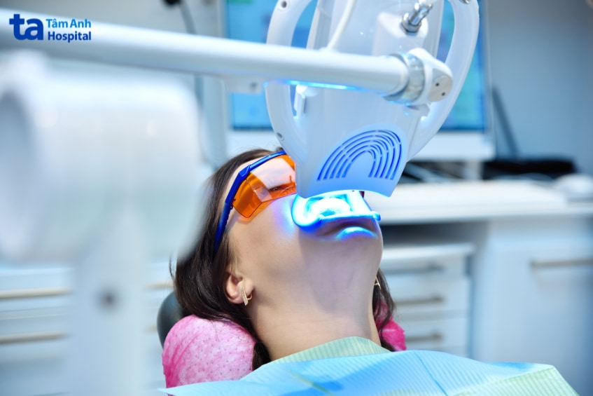 tác hại tẩy trắng răng