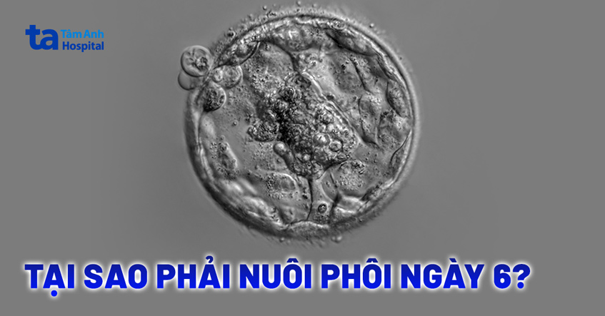Tại sao phải nuôi phôi ngày 6?