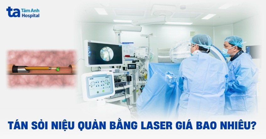 tán sỏi niệu quản bằng laser giá bao nhiêu