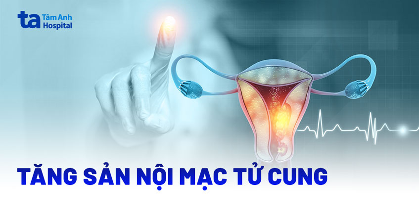 tăng sản nội mạc tử cung