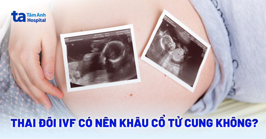 Thai đôi IVF có nên khâu cổ tử cung không? Chỉ định khi nào?