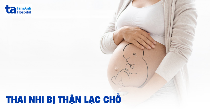 Thai nhi bị thận lạc chỗ: Nguyên nhân, dấu hiệu và cách điều trị