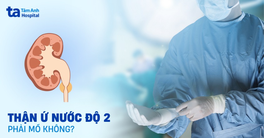 Thận ứ nước độ 2 có phải mổ không? Chỉ định khi nào?