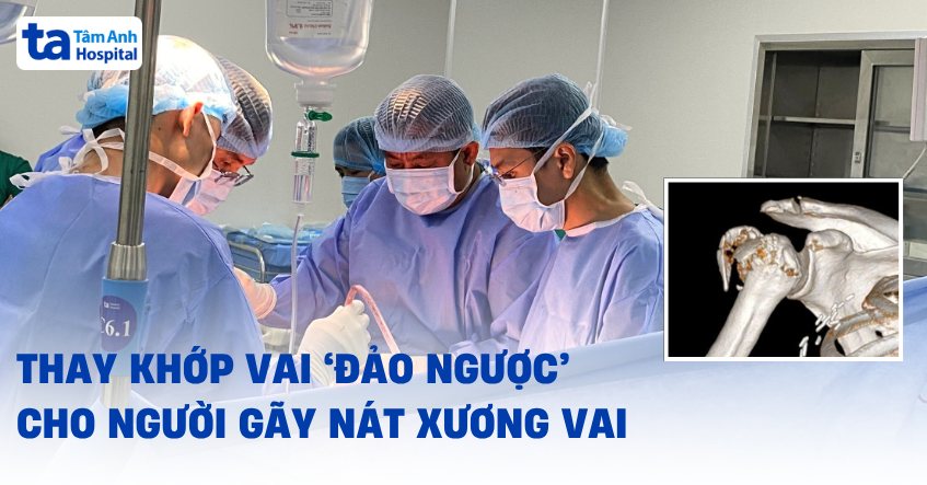 Thay khớp vai ‘đảo ngược’ cho người gãy nát xương vai