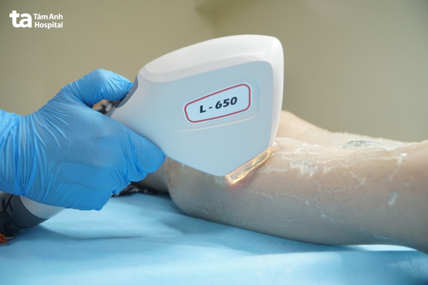 thời điểm mẹ bầu không nên triệt lông