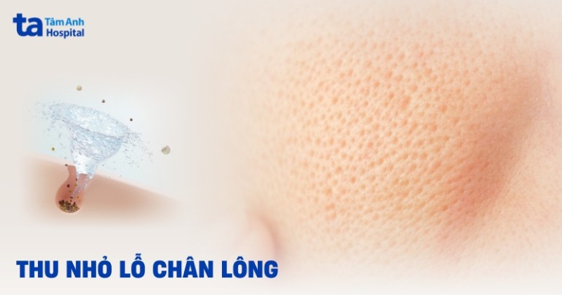 20 cách thu nhỏ lỗ chân lông tại nhà đơn giản, hiệu quả cao
