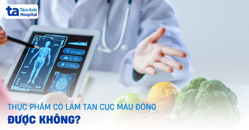 15 thực phẩm làm tan cục máu đông có thật sự hiệu quả không?