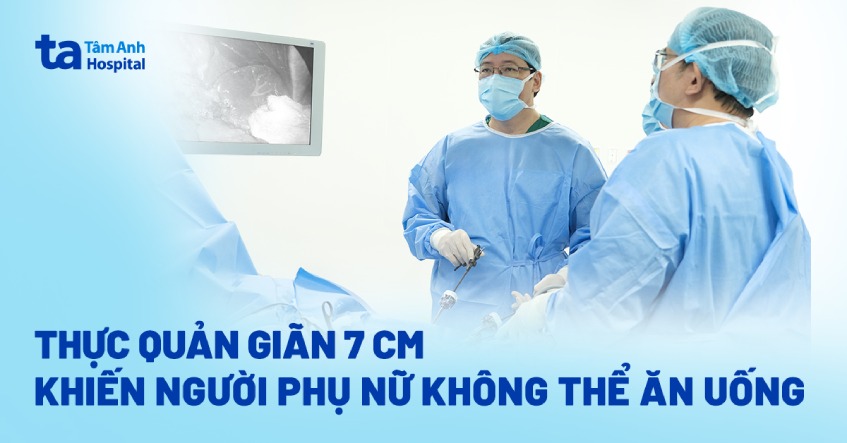 thực quản giãn 7cm
