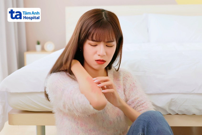 thuốc bôi điều trị zona