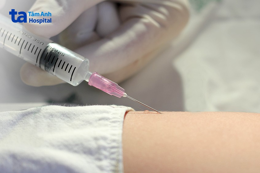 thuốc tê có thể gây dị ứng