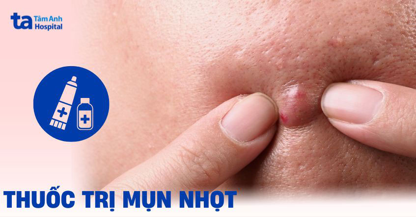 Gợi ý 5 thuốc trị mụn nhọt thường được khuyến nghị hiện nay