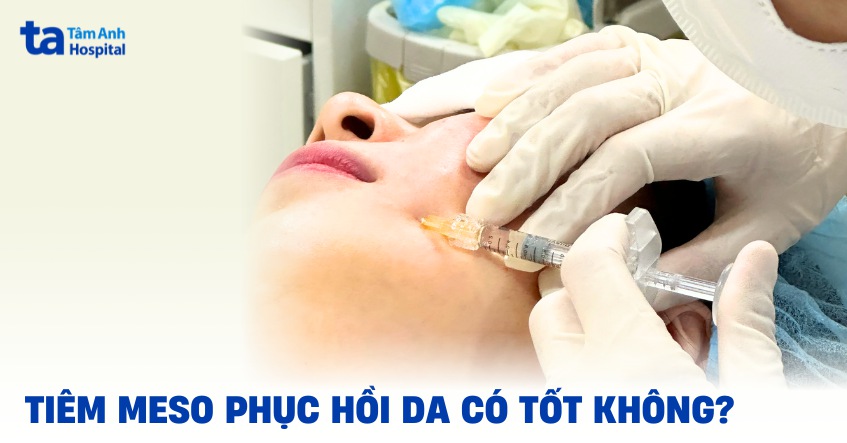 tiêm meso phụ hồi da có tốt không