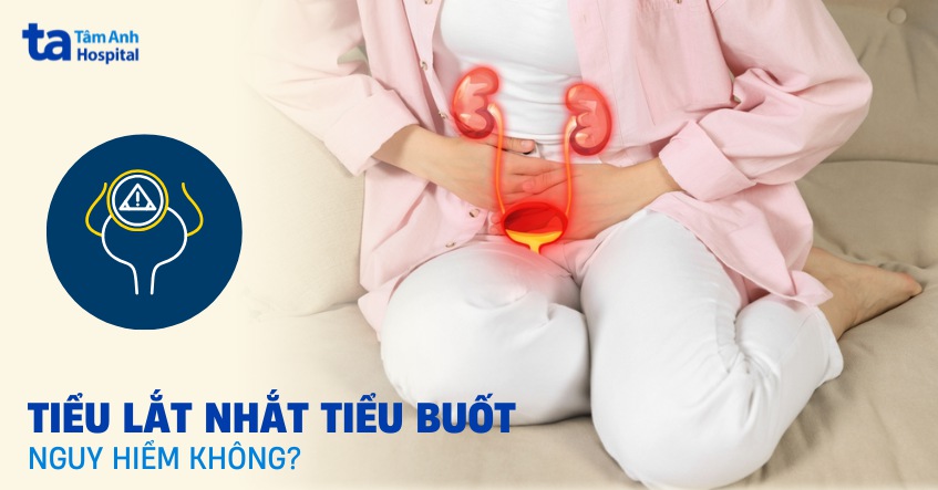 Tiểu lắt nhắt tiểu buốt có nguy hiểm không? Tìm hiểu nguyên nhân