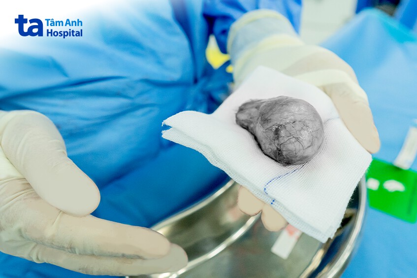 tinh hoàn của người bệnh