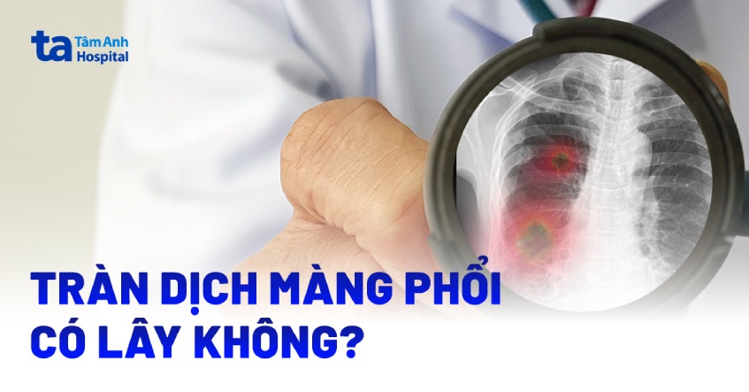 Tràn dịch màng phổi có lây không? Lây qua đường nào?