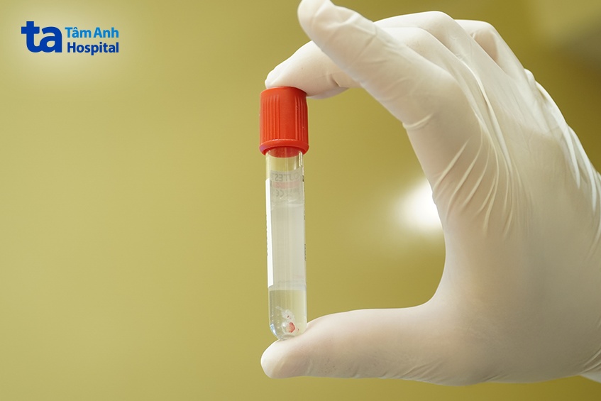 tràn dịch màng phổi liên quan trực tiếp đến tế bào ung thư