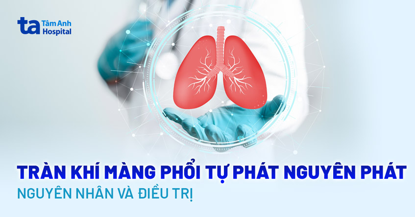 Tràn khí màng phổi tự phát nguyên phát: Nguyên nhân và điều trị