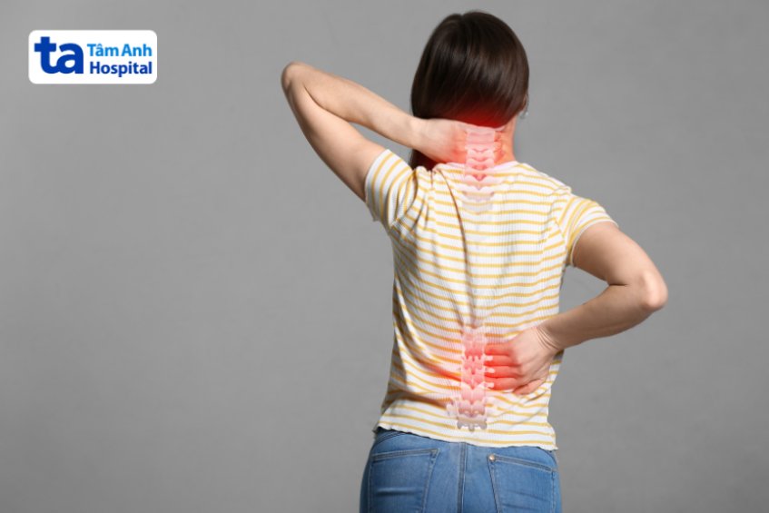 Triệu chứng rách vòng xơ đĩa đệm