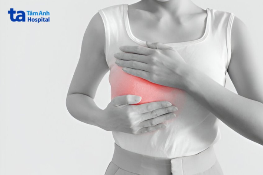 Triệu chứng vú nhọn