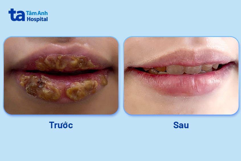 trước và sau khi chữa trị