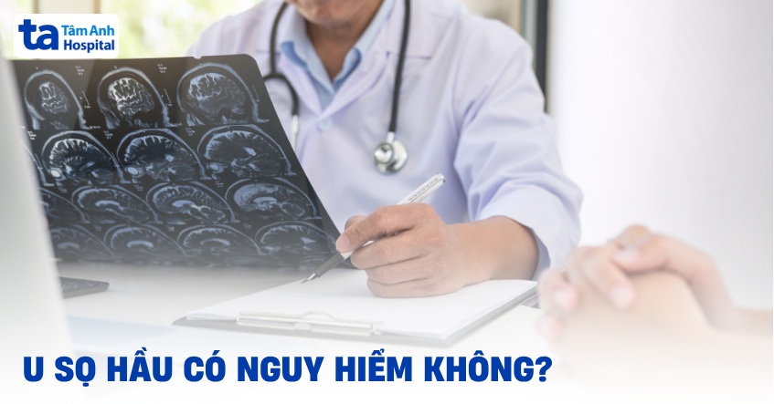 U sọ hầu có nguy hiểm không? Ảnh hưởng sức khỏe như thế nào?