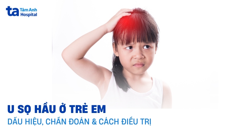 U sọ hầu ở trẻ em: Dấu hiệu, nguyên nhân, chẩn đoán và điều trị