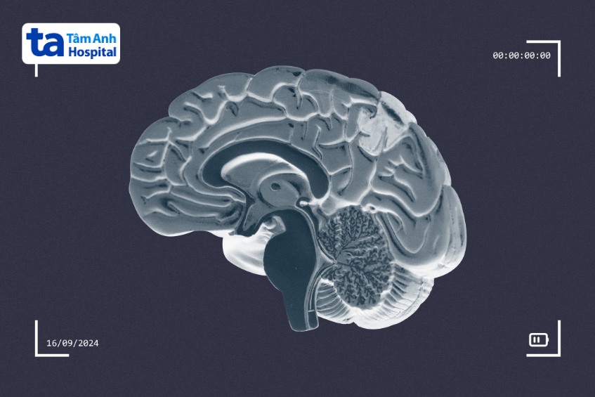 u tiểu não là gì