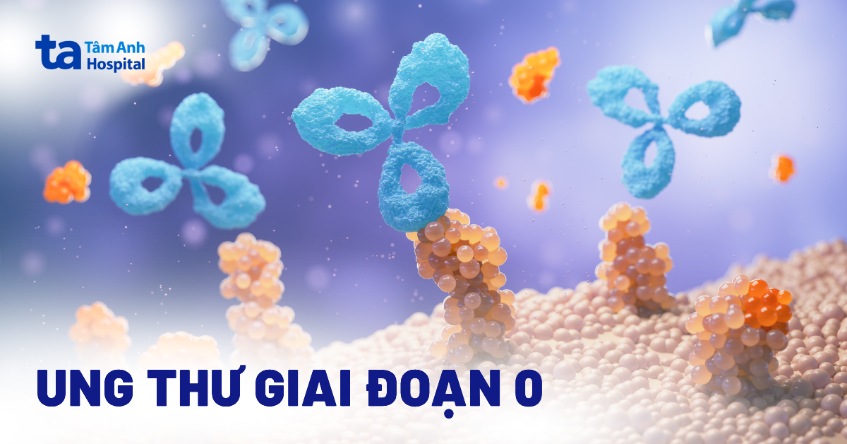 Ung thư giai đoạn 0 là gì? Cách điều trị và tiên lượng bệnh