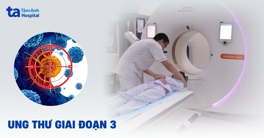Ung thư giai đoạn 3: Dấu hiệu, chẩn đoán và cách điều trị