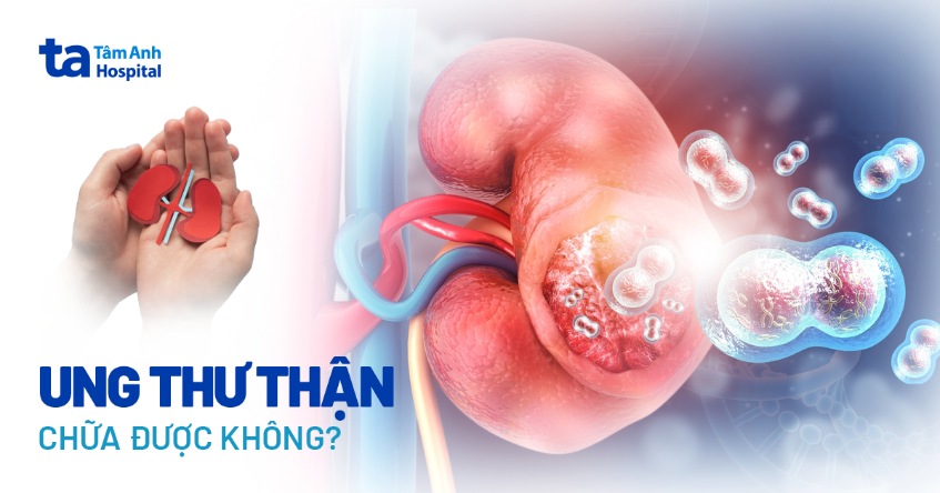 Ung thư thận có chữa được không? Yếu tố nào ảnh hưởng điều trị?